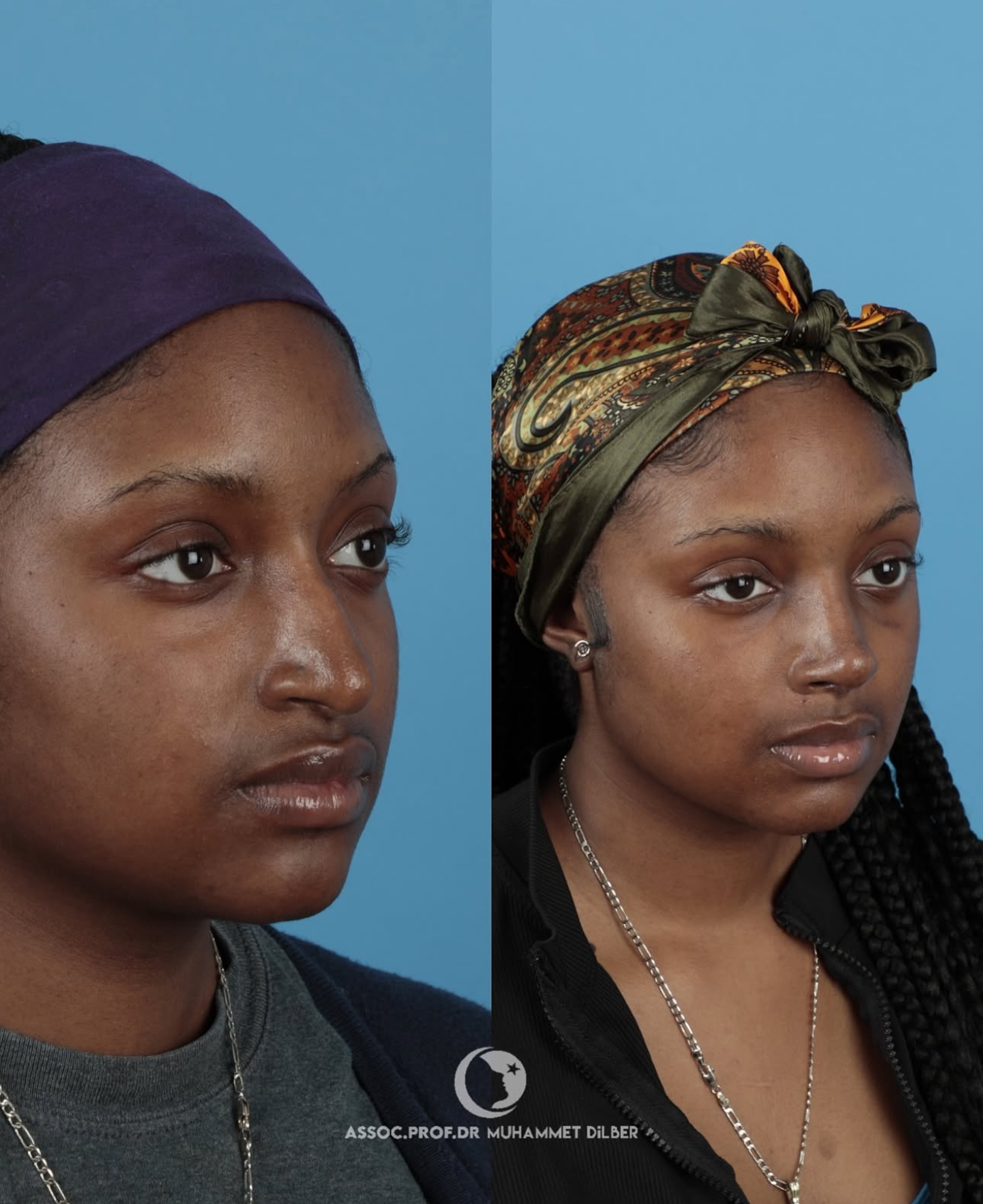 Source: Assoc. Prof. Dr. Muhammet Dilber (EZ Newswire)