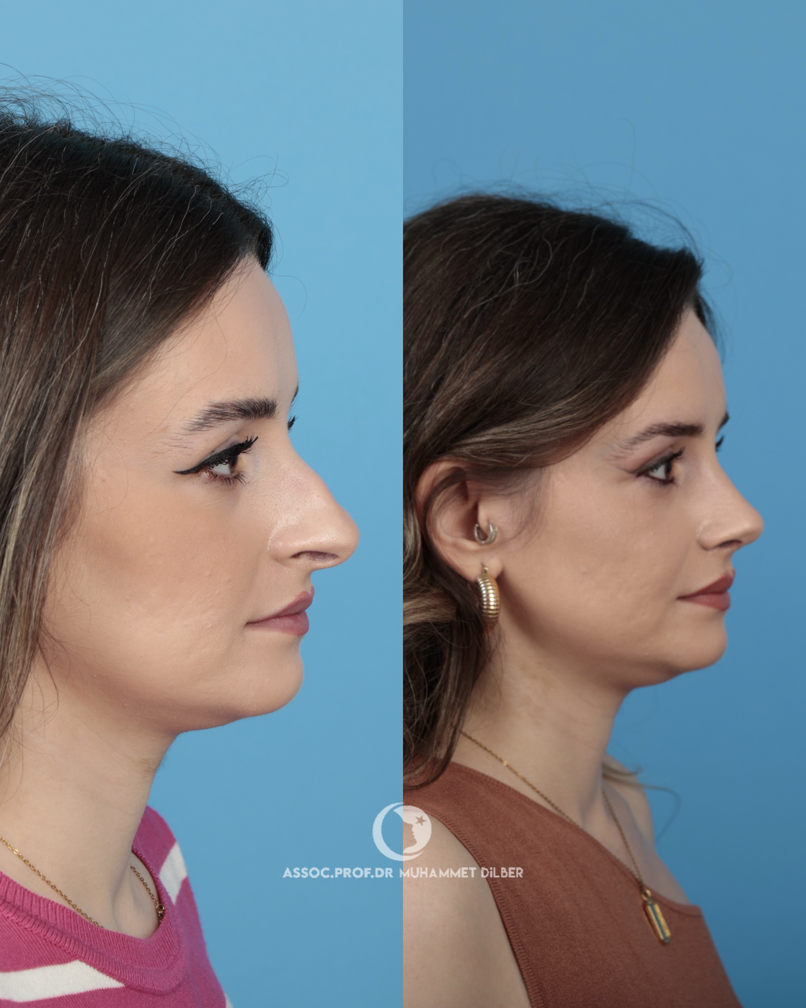 Source: Assoc. Prof. Dr. Muhammet Dilber (EZ Newswire)