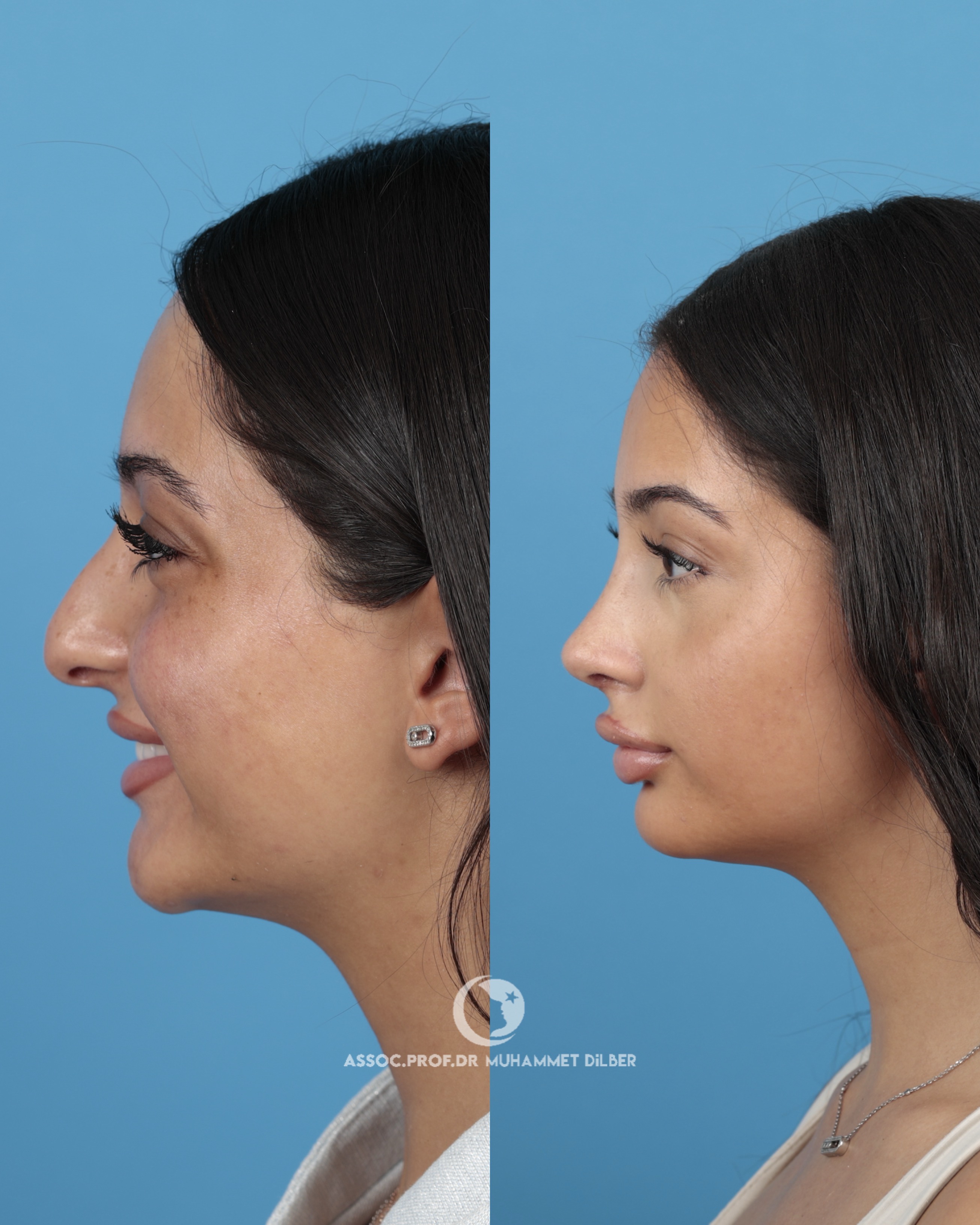 Source: Assoc. Prof. Dr. Muhammet Dilber (EZ Newswire)