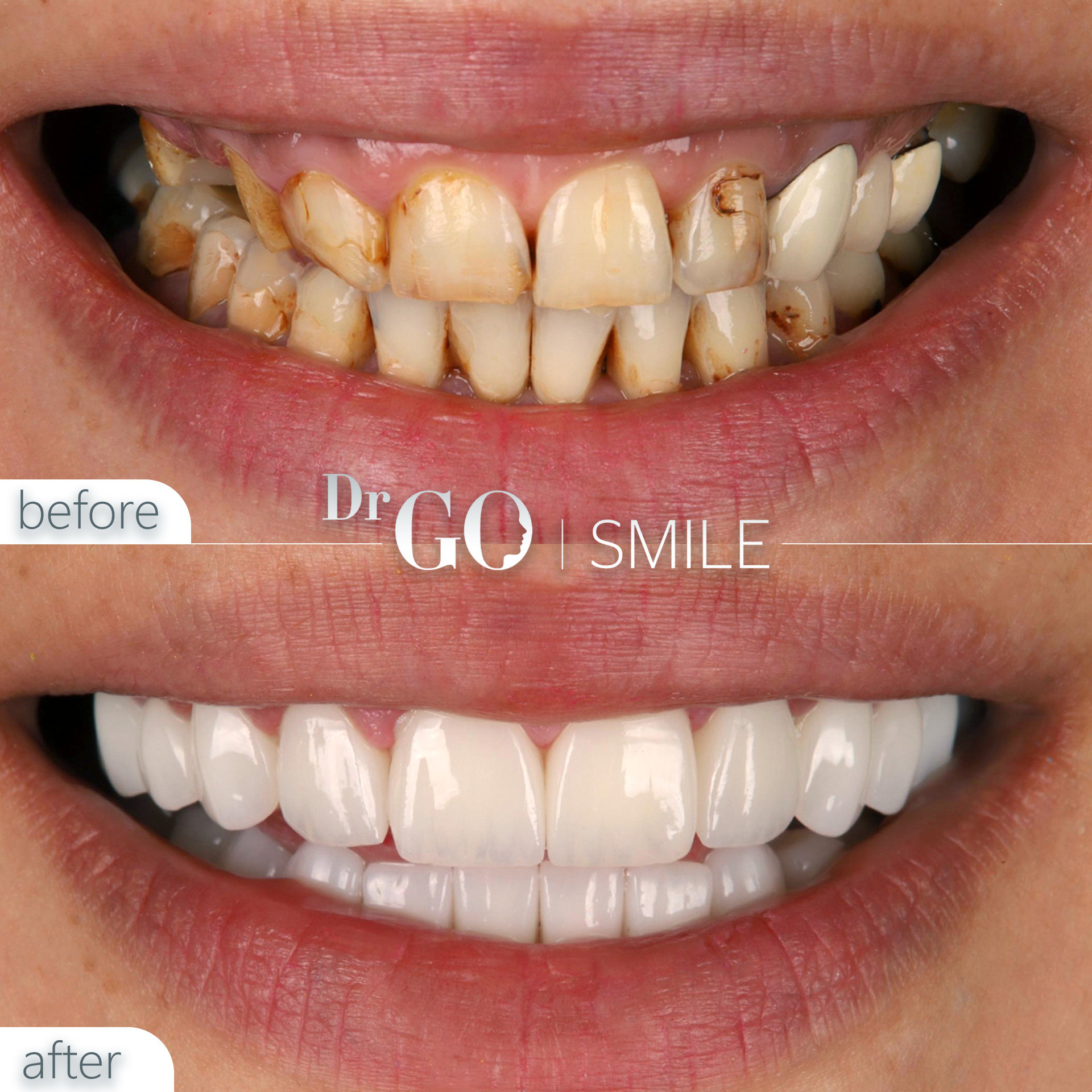 Source: DRGO Clinic (EZ Newswire)