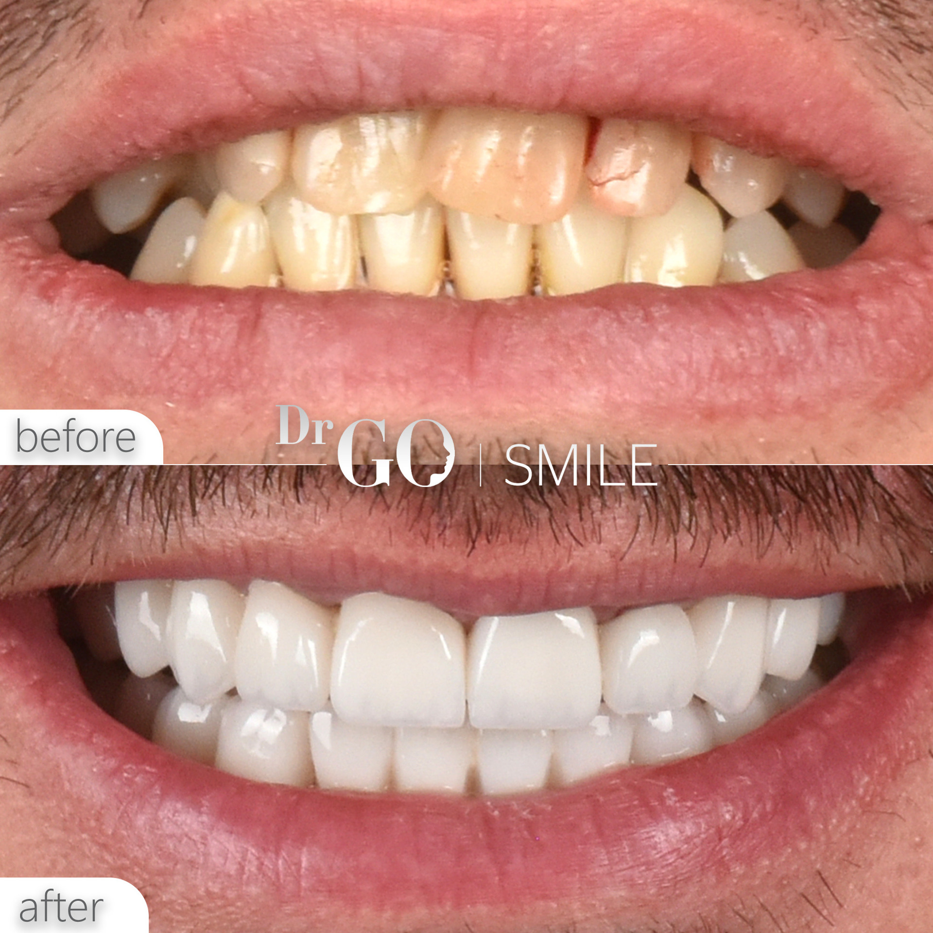 Source: DRGO Clinic (EZ Newswire)