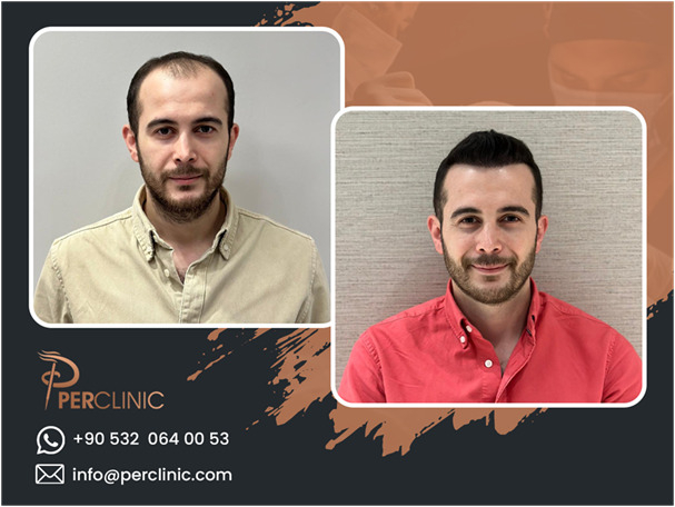 Source: Per Clinic (EZ Newswire)