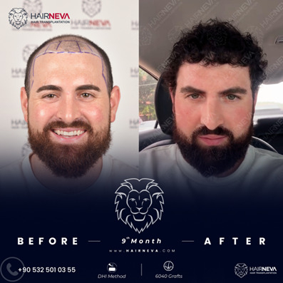 Source: Crabs Media (EZ Newswire)