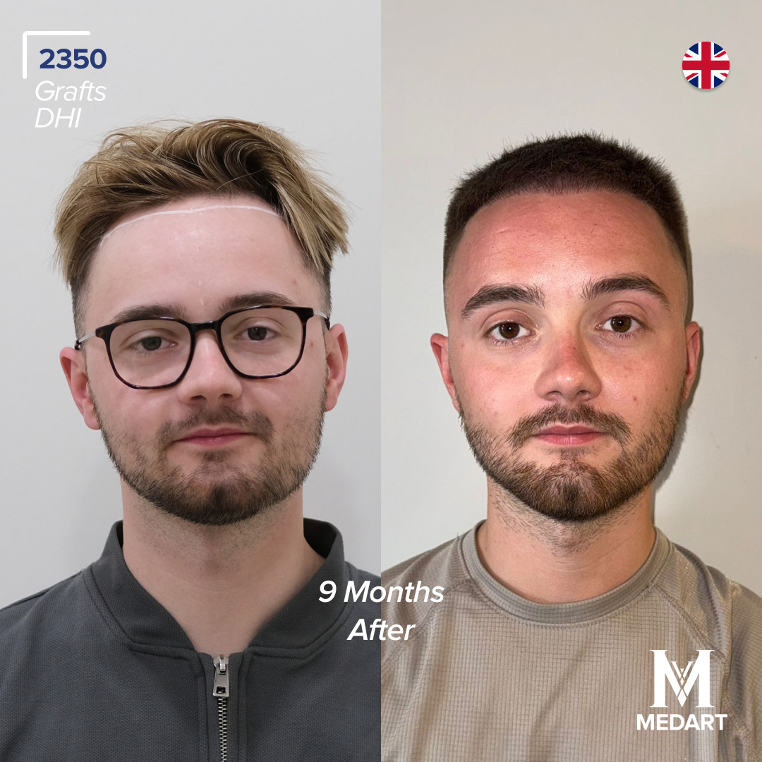 Source: Crabs Media (EZ Newswire)