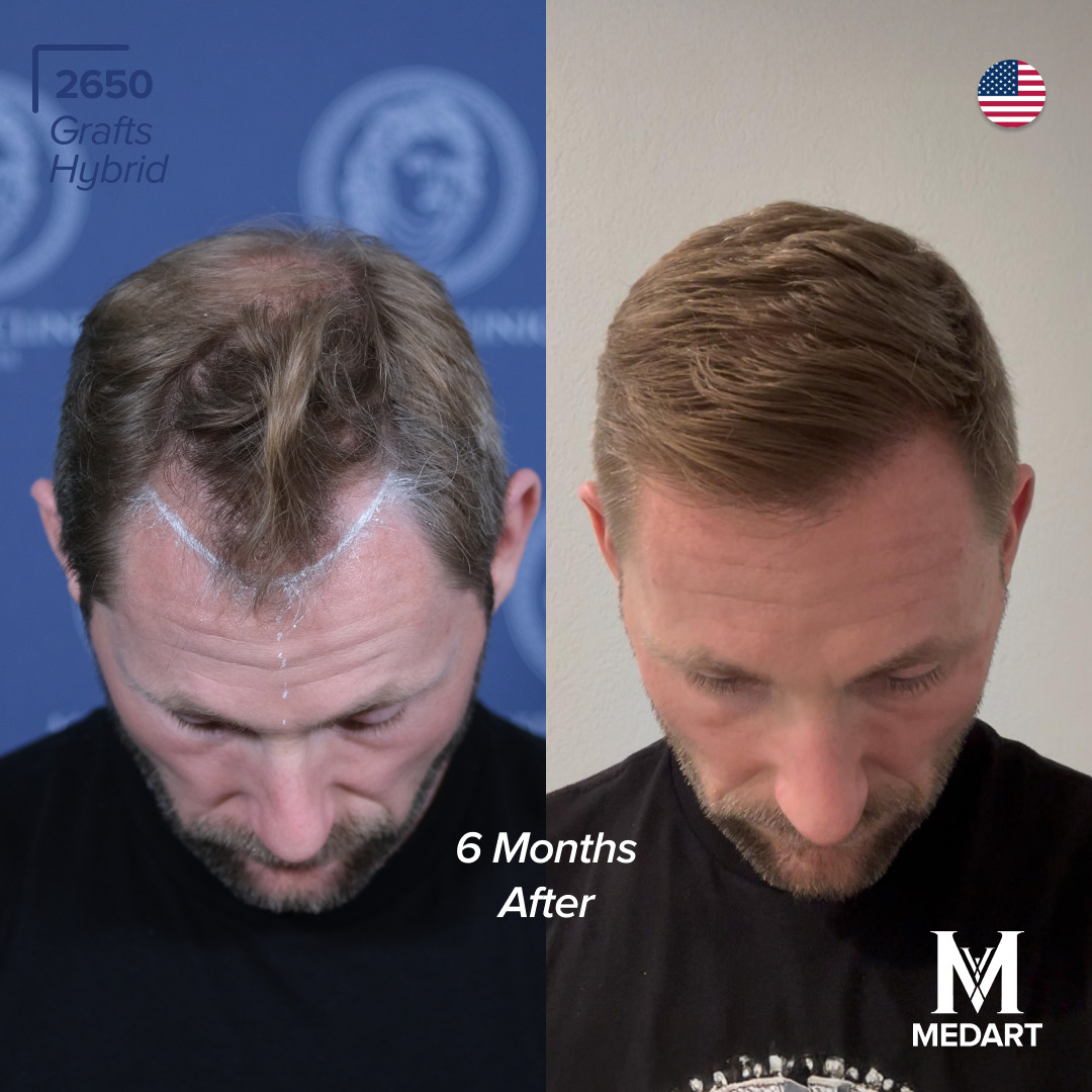 Source: Crabs Media (EZ Newswire)