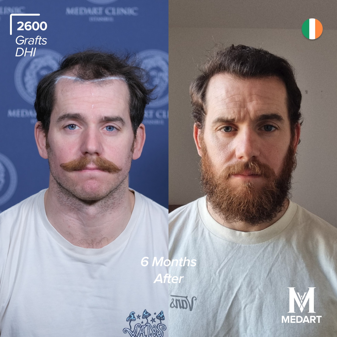 Source: Crabs Media (EZ Newswire)