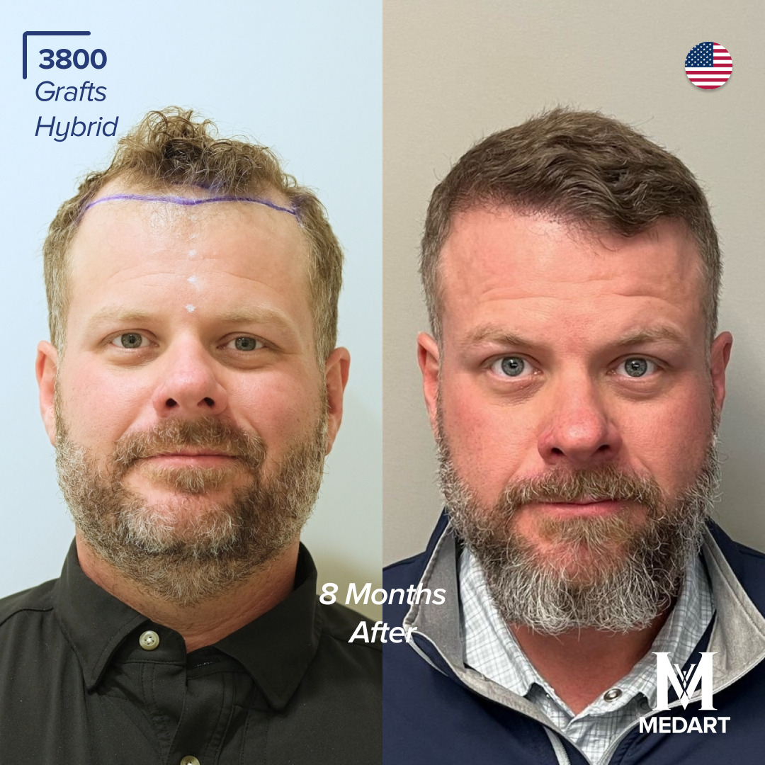 Source: Crabs Media (EZ Newswire)