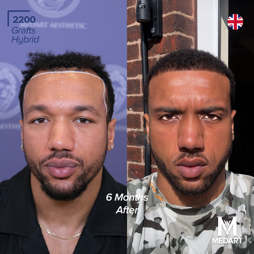 Source: Crabs Media (EZ Newswire)