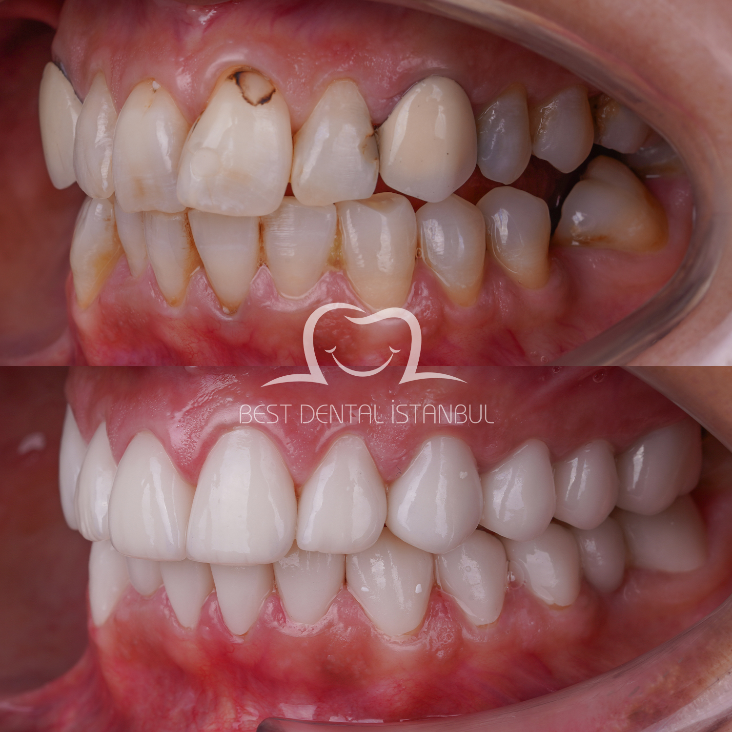 Source: Best Dental İstanbul (EZ Newswire)