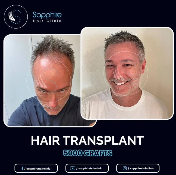 Sapphire Hair Clinic / Source: Crabs Media (EZ Newswire)