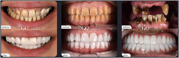 Source: DRGO Clinic (EZ Newswire)