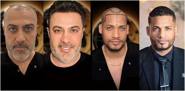 Source: Asli Tarcan Global (EZ Newswire)