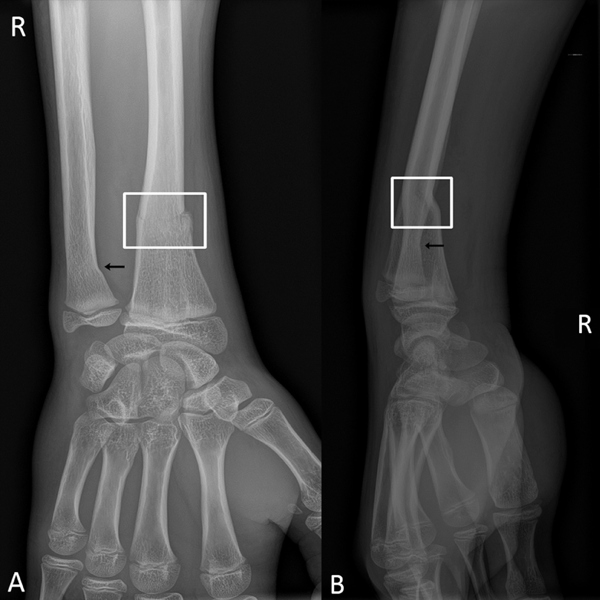 ai in trauma radiology