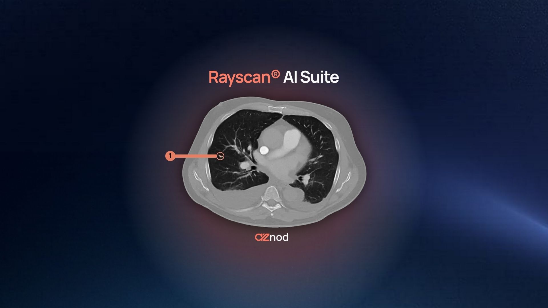 AZnod Available for CT Imaging Following CE Marking