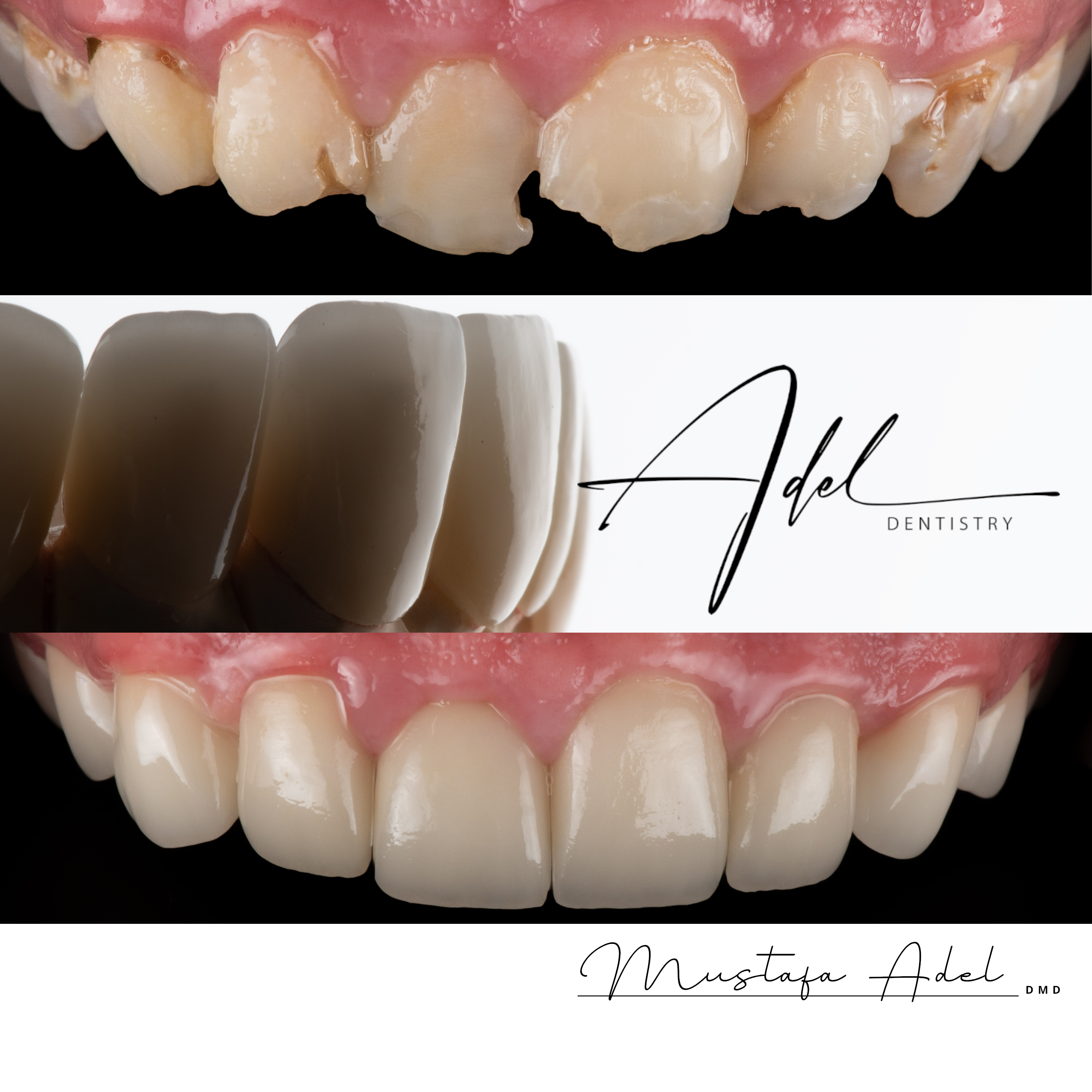 Young Patient Smile - Adel Dentistry Tampa FL