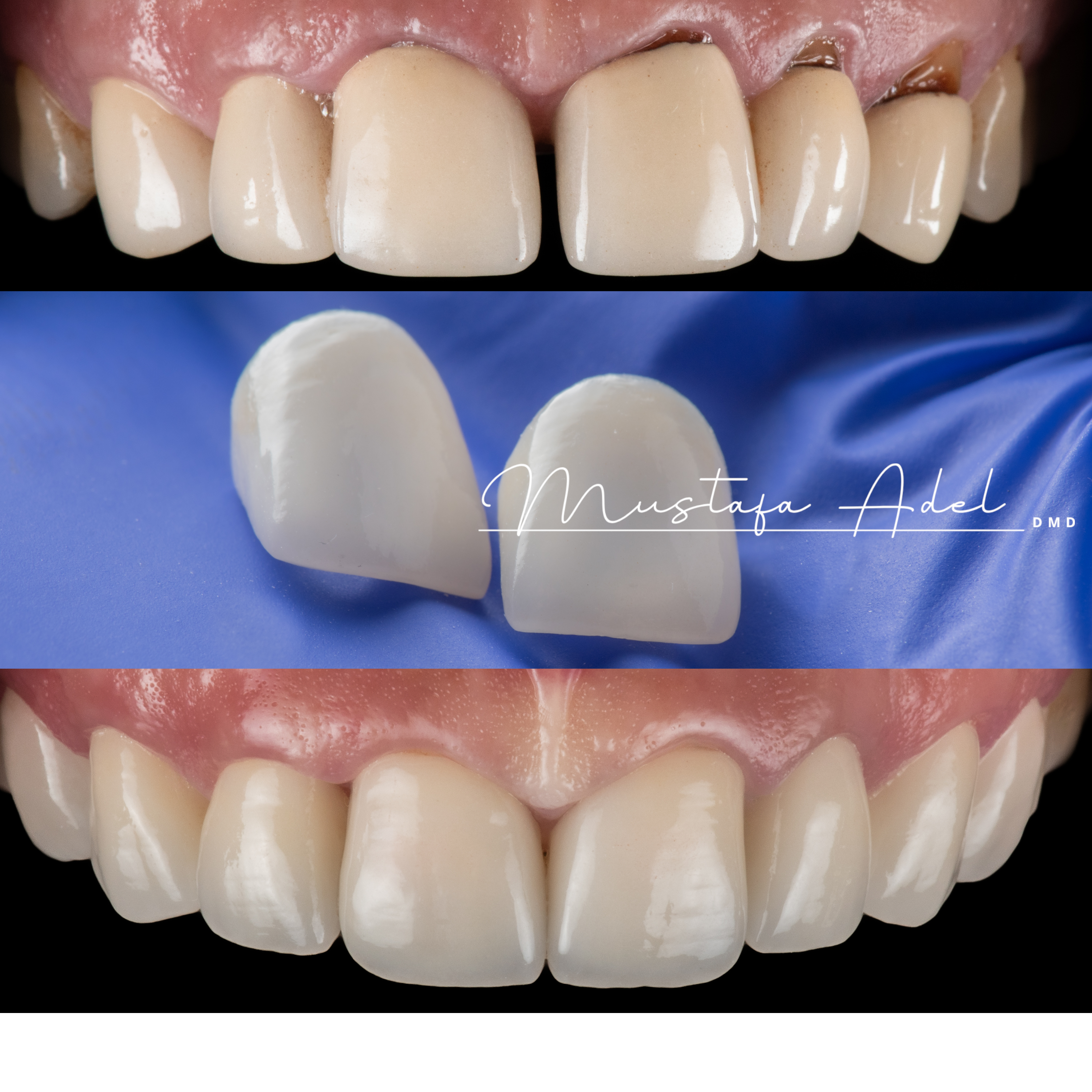 Dog Lady Before After - Adel Dentistry Tampa FL