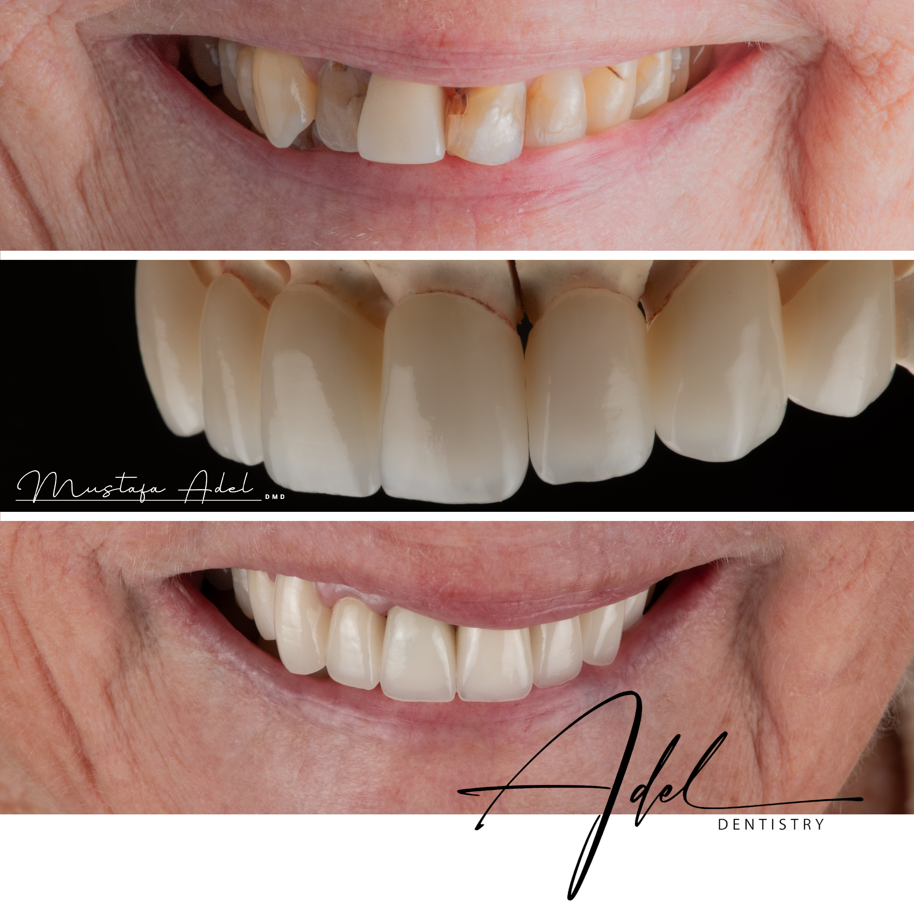 Wedding Smile Makeover - Adel Dentistry Tampa FL