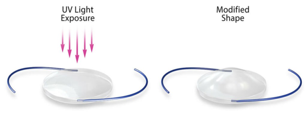 Light Adjustable Lens