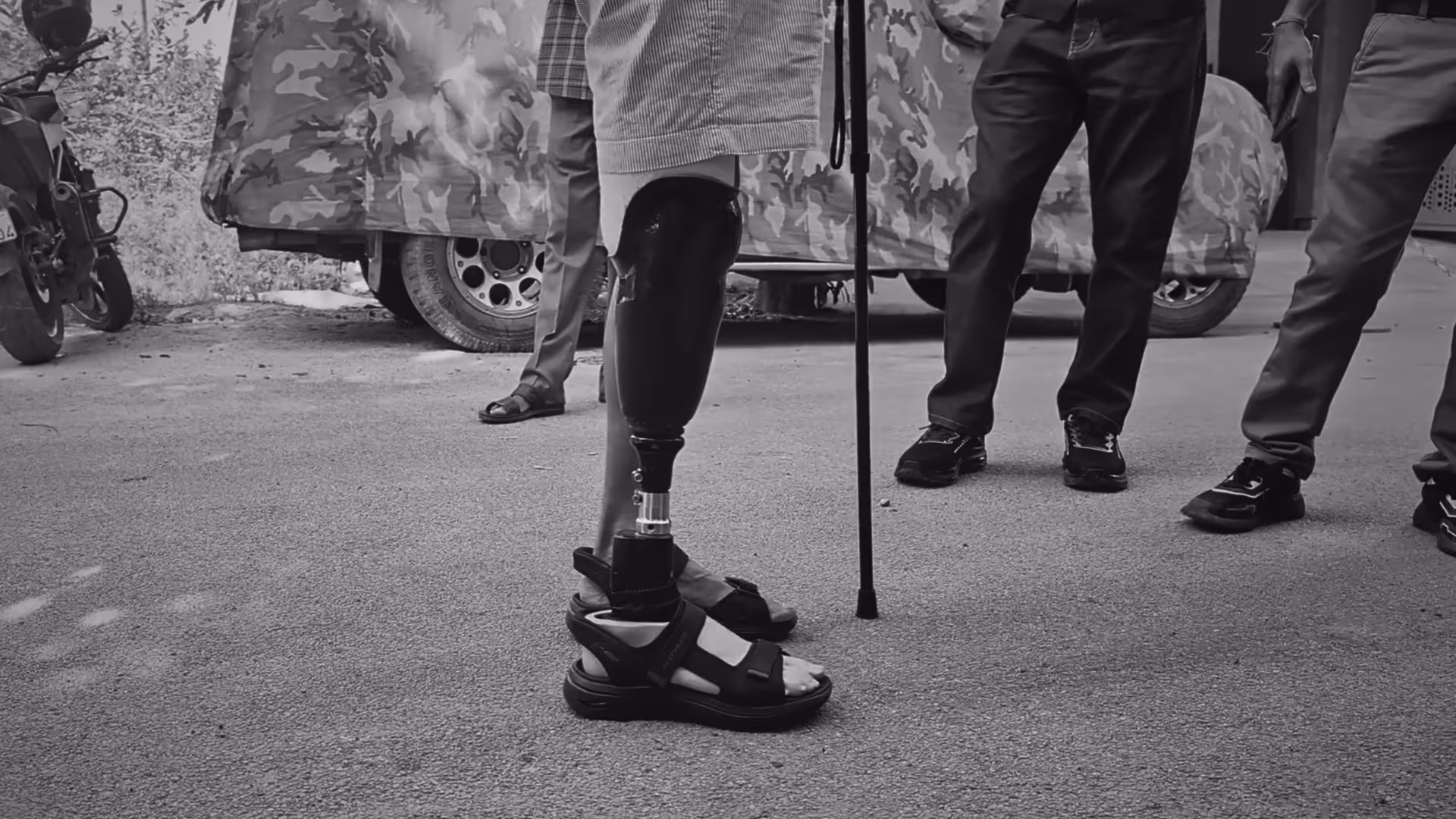 A patient of Rise Bionics wearing a prosthetic leg with a proprio foot - a type of bionic prosthetic foot.