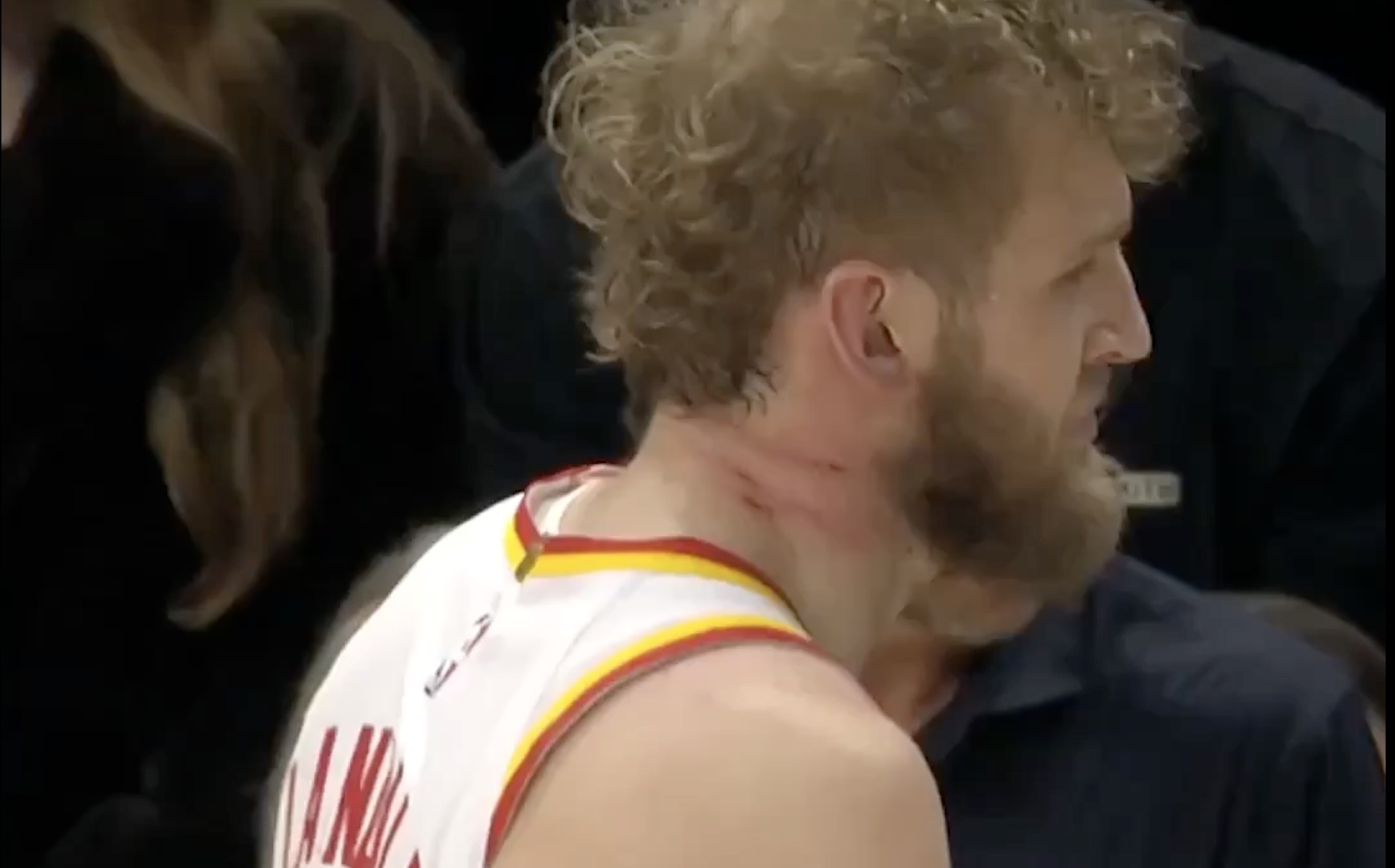 Peacemaker Landale scratched, clawed vs T'Wolves