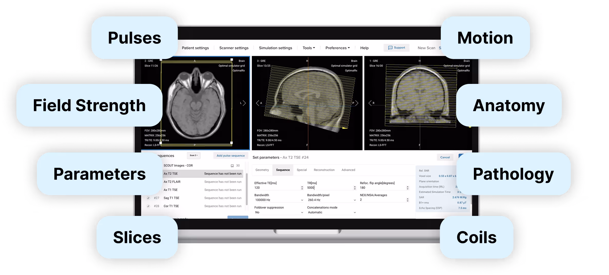 Corsmed's MRI simulator interface surrounded by labeled tags.
Each label represents an adjustable input or setting in Corsmed’s MRI simulator that affects the resulting image.
Left side tags: Pulses, Field Strength, Parameters, Slices.
Right side tags: Motion, Anatomy, Pathology, Coils.
The simulator screen shows axial, sagittal, and coronal planning views.