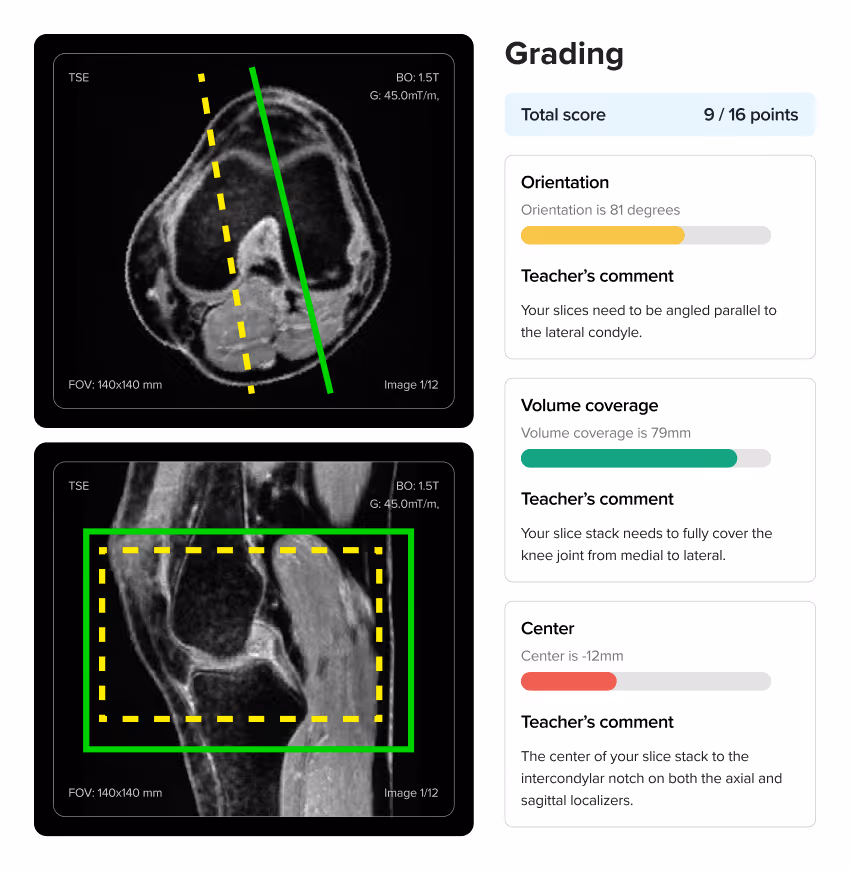 Screenshot of Corsmed's automated grading panel for a knee MRI exercise, showing a student's slice planning scored at 9 out of 16 points with instant feedback on orientation, volume coverage, and centering.