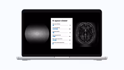Corsmed's k-space viewer tool displayed on a laptop