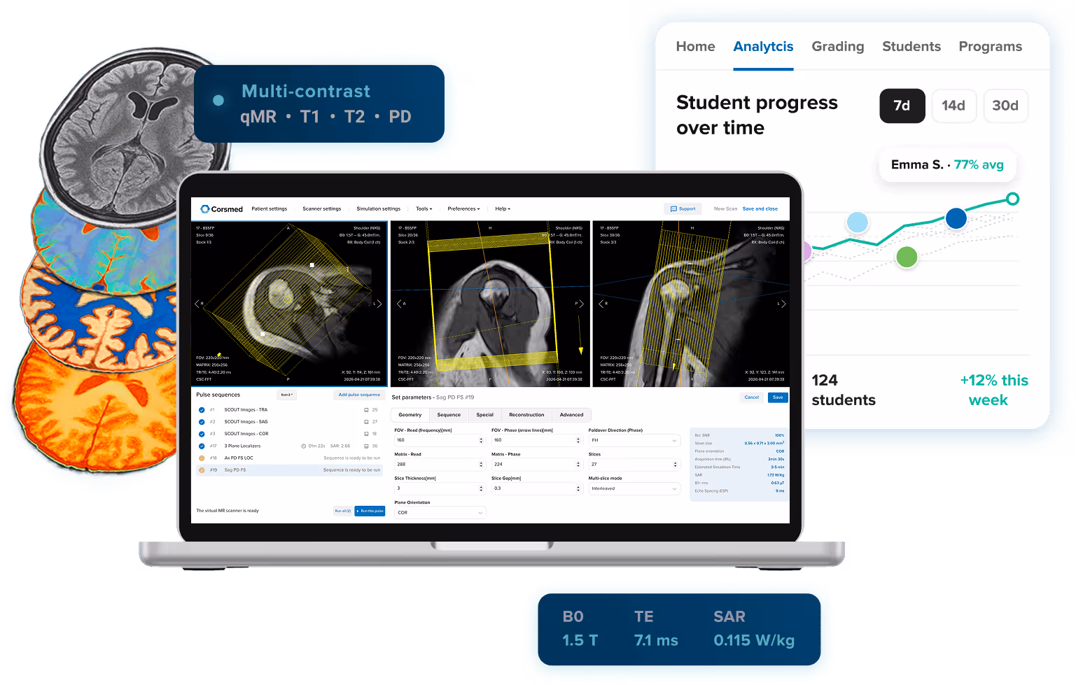 Hero image for the Corsmed homepage, showing the MRI simulator interface on a laptop at the center, with a stack of multi-contrast brain MRI images on the left representing the Simulation-Based Reconstruction (SBR) investigational product, and a student analytics dashboard on the right representing the Corsmed LMS.