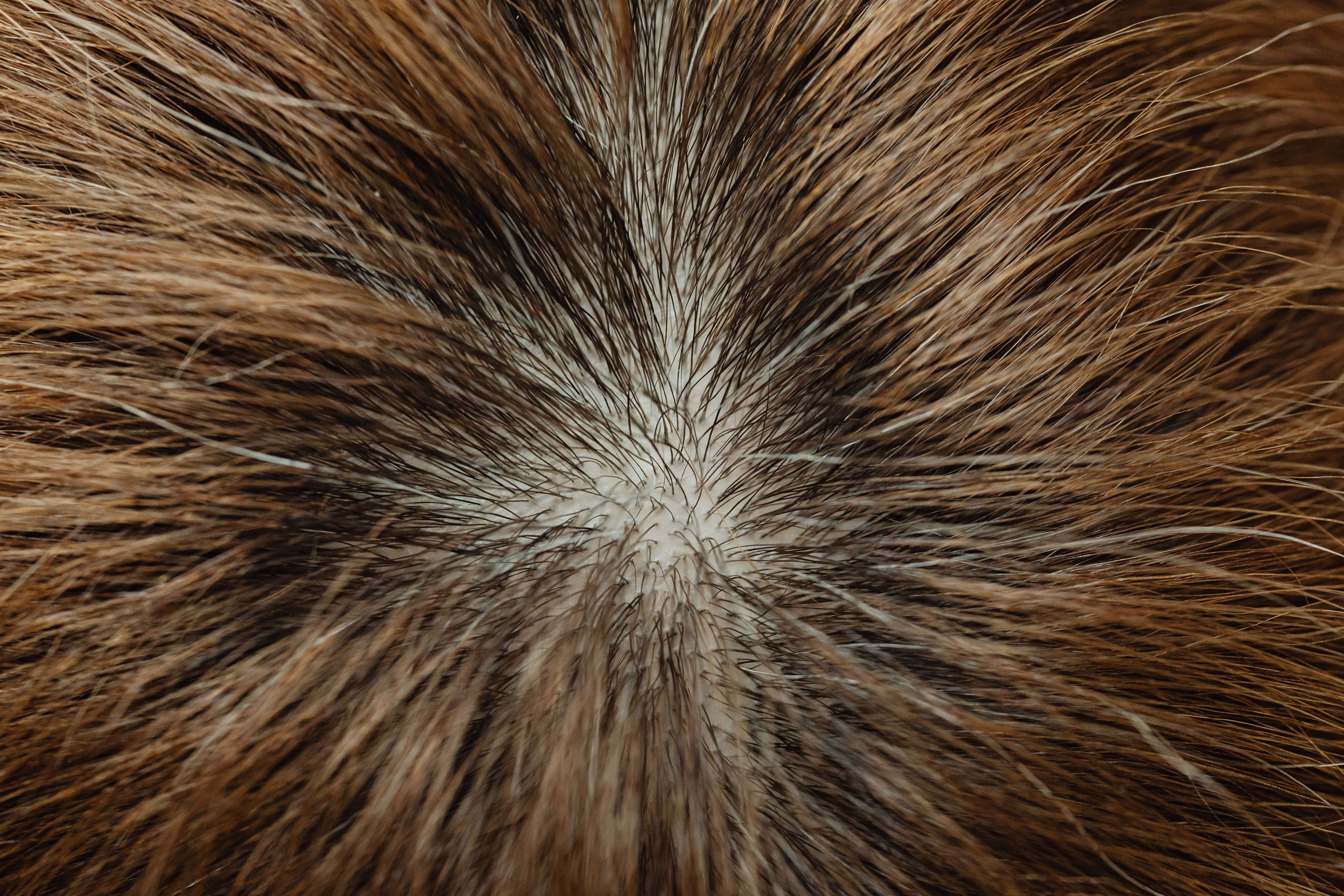 Gros plan sur le cuir chevelu et les cheveux. Image pour l'analyse capillaire et la prise en charge de l'alopécie en France.