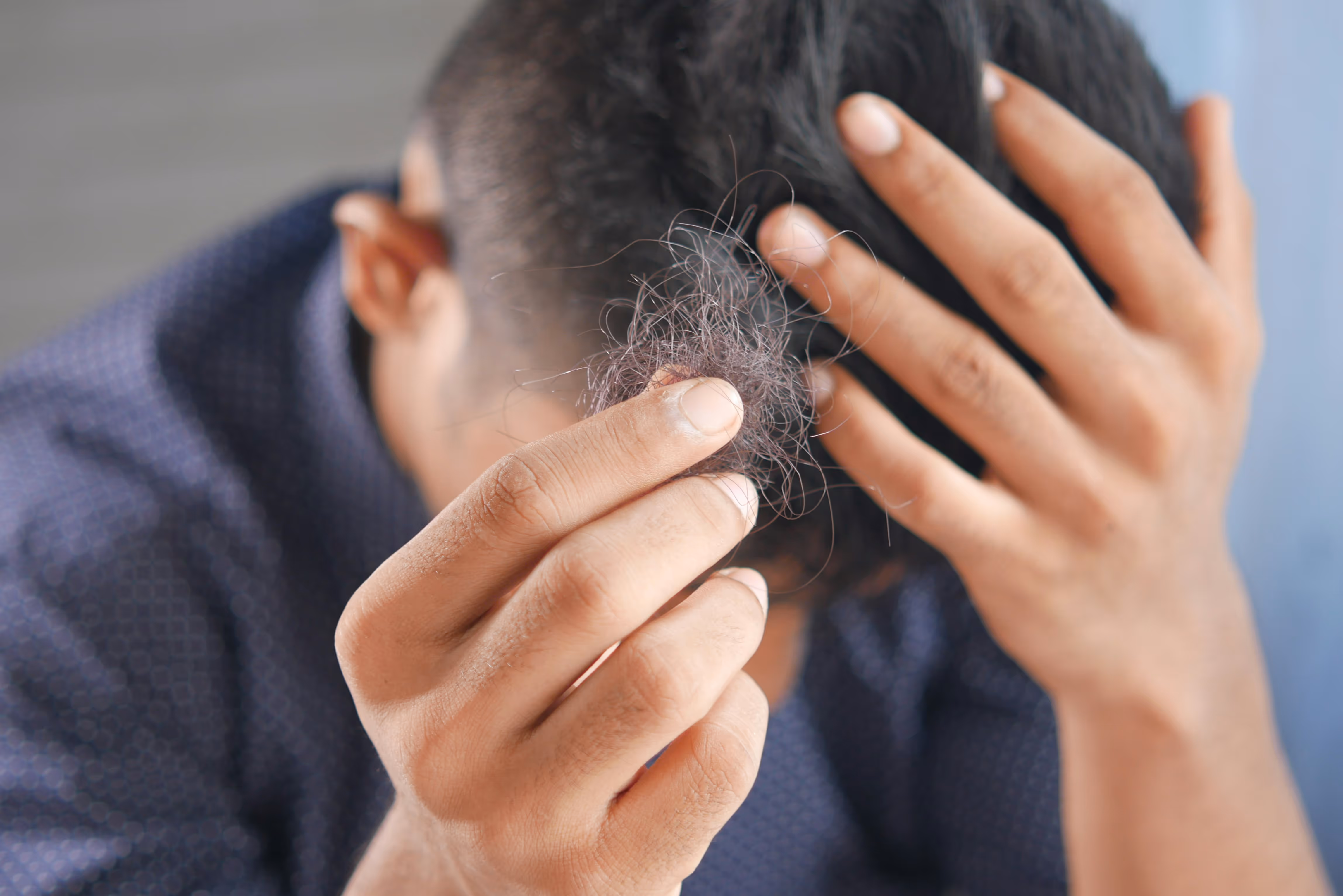 Gros plan sur une main tenant des cheveux tombés, représentant la chute de cheveux et les signes de l'alopécie.