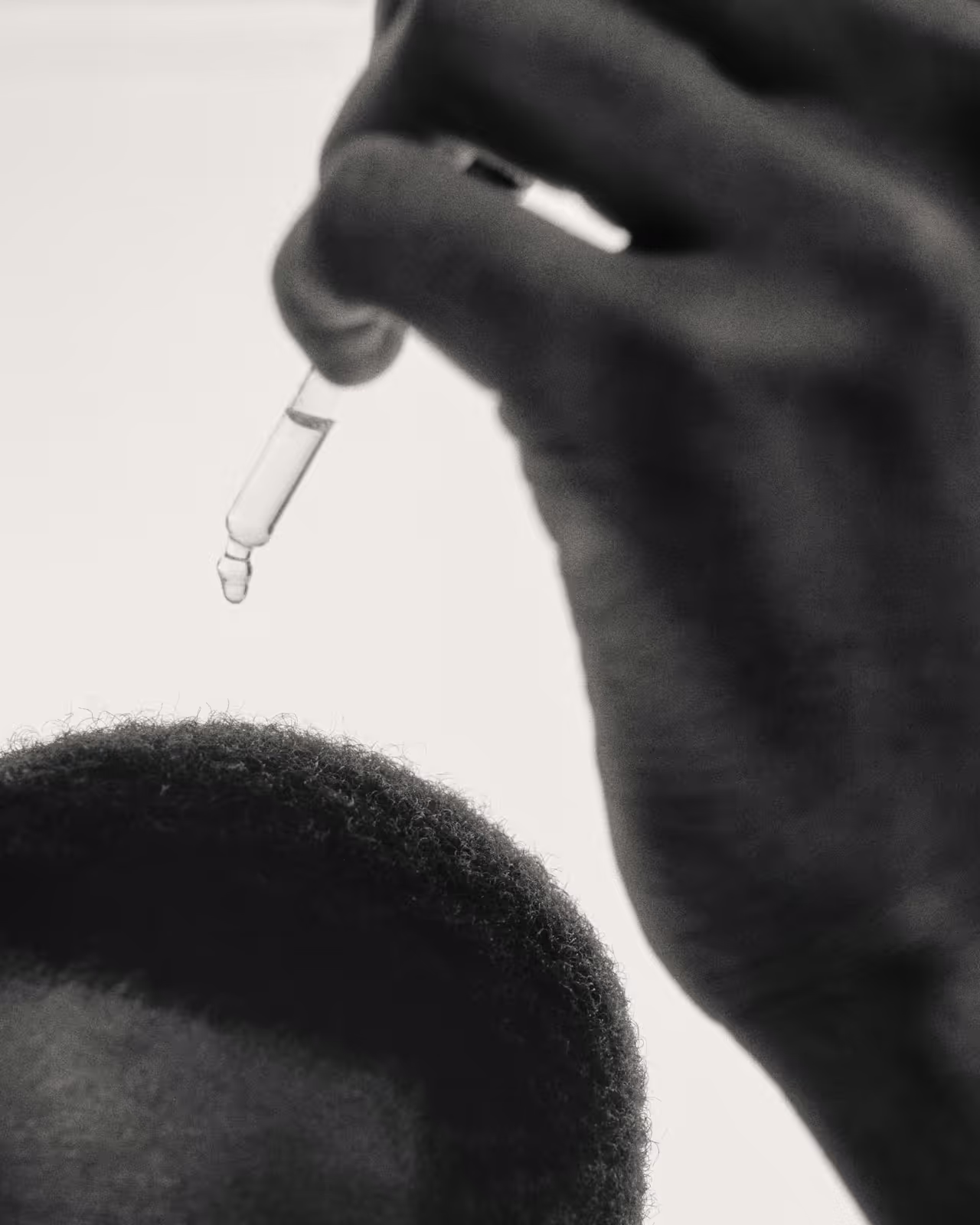 Application de gouttes de sérum sur le cuir chevelu pour lutter contre la perte de cheveux chez l'homme.