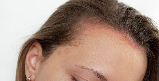 Nutritional Counceling