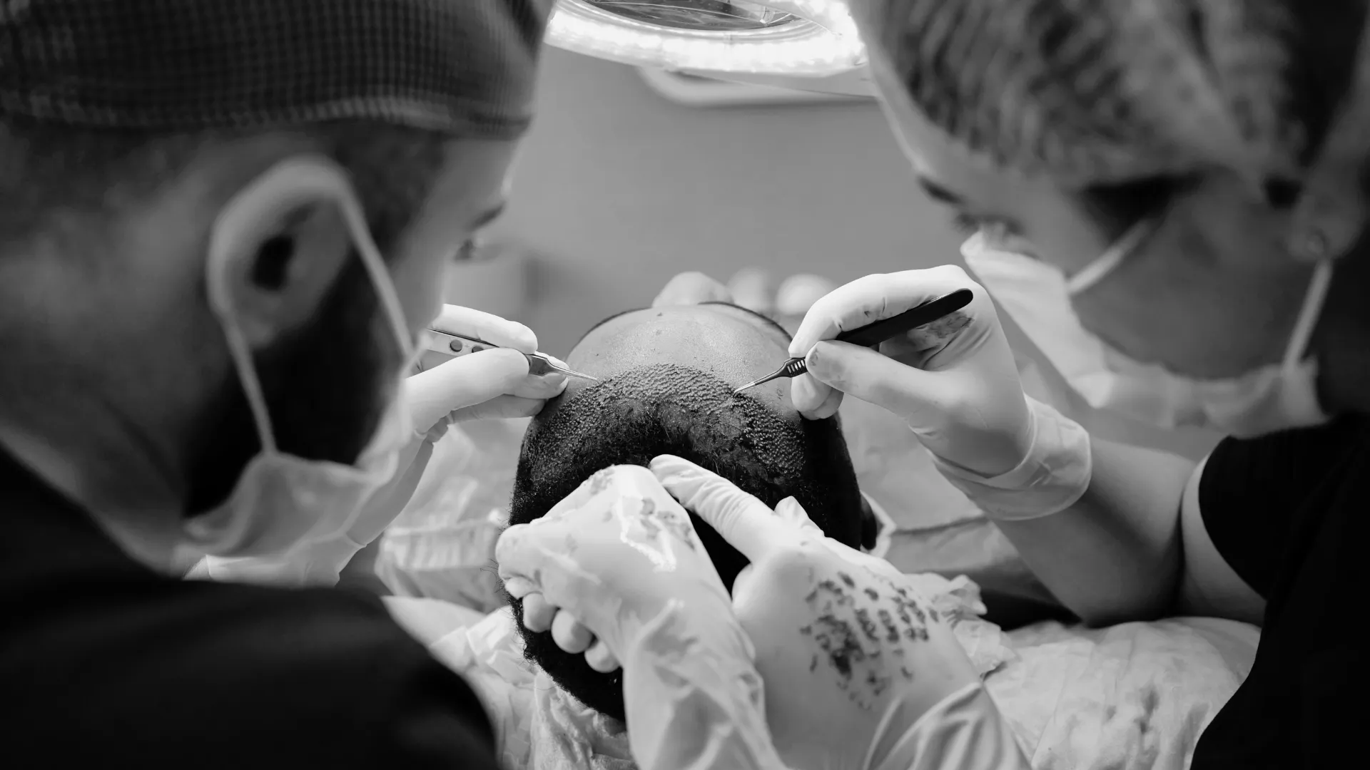 Why Larnaca Is Becoming a Hotspot for DHI Hair Transplants in Cyprus
