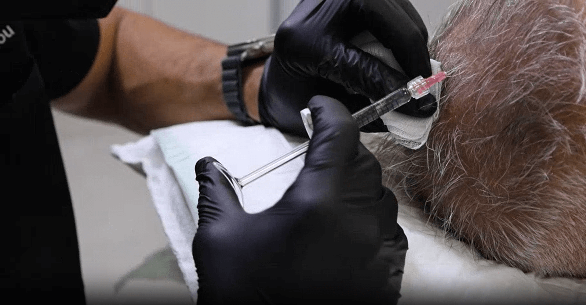 Τι είναι το Lapuroon; Οδηγός αναζωογόνησης δέρματος