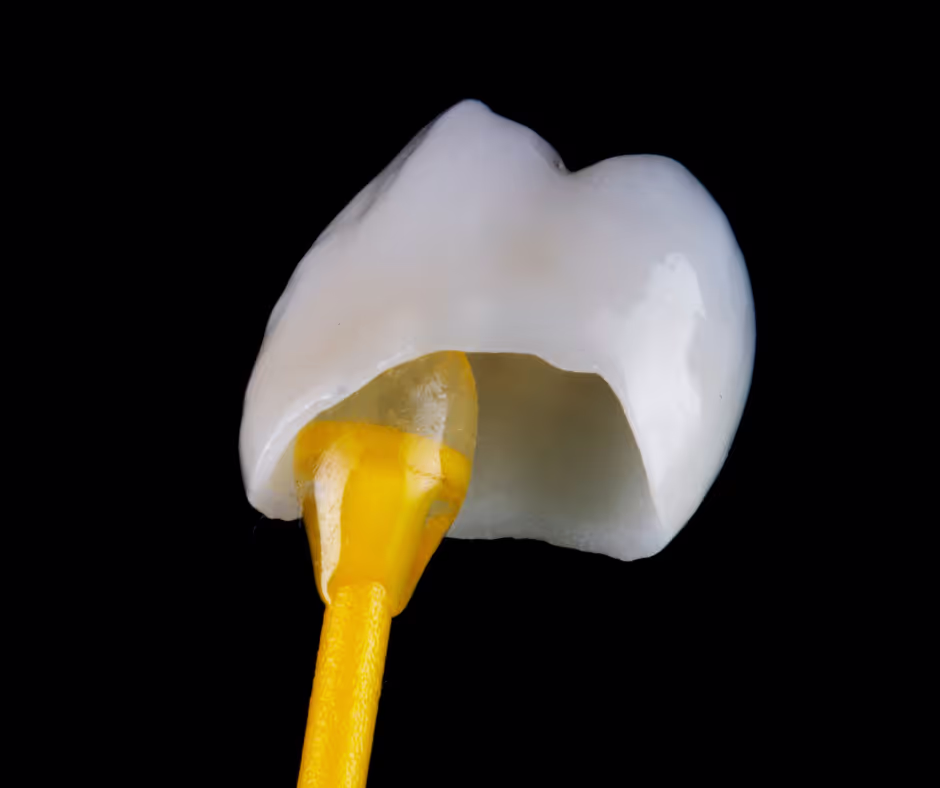 Image of a single dental crown on a black background