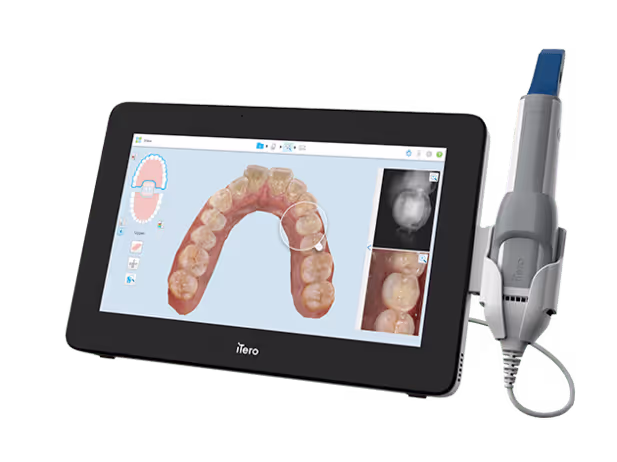 Screen showing image of top row of teeth