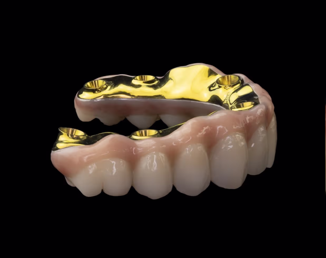 All on X dental implant from the side