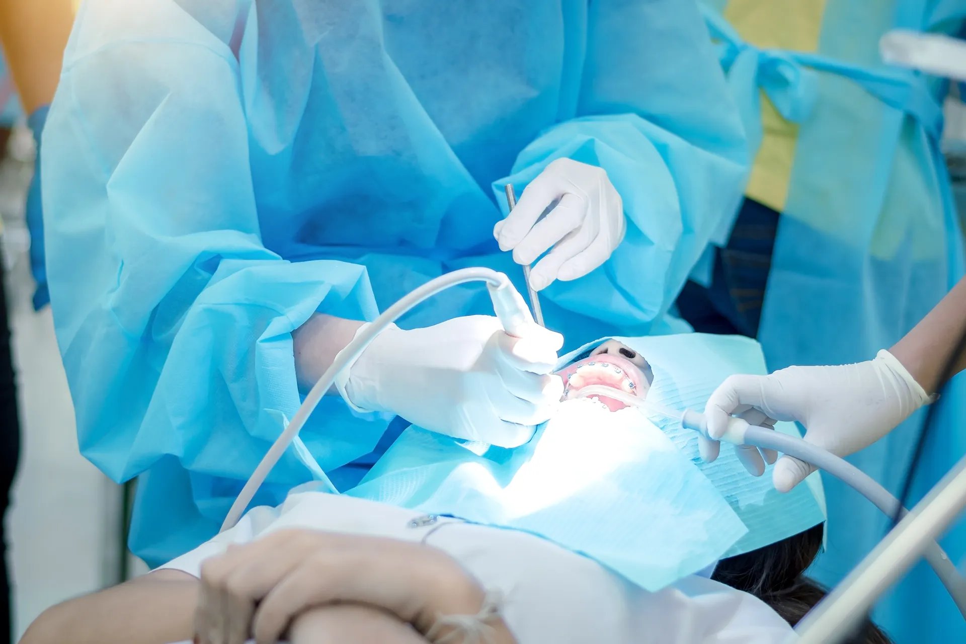 Dental surgeon removing wisdom teeth