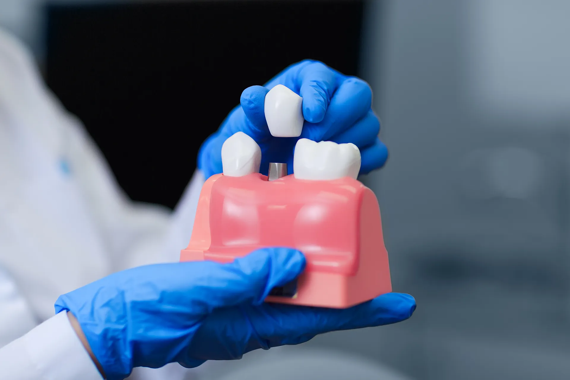 A dentist demonstrating a single tooth implant going onto a screw into the gum