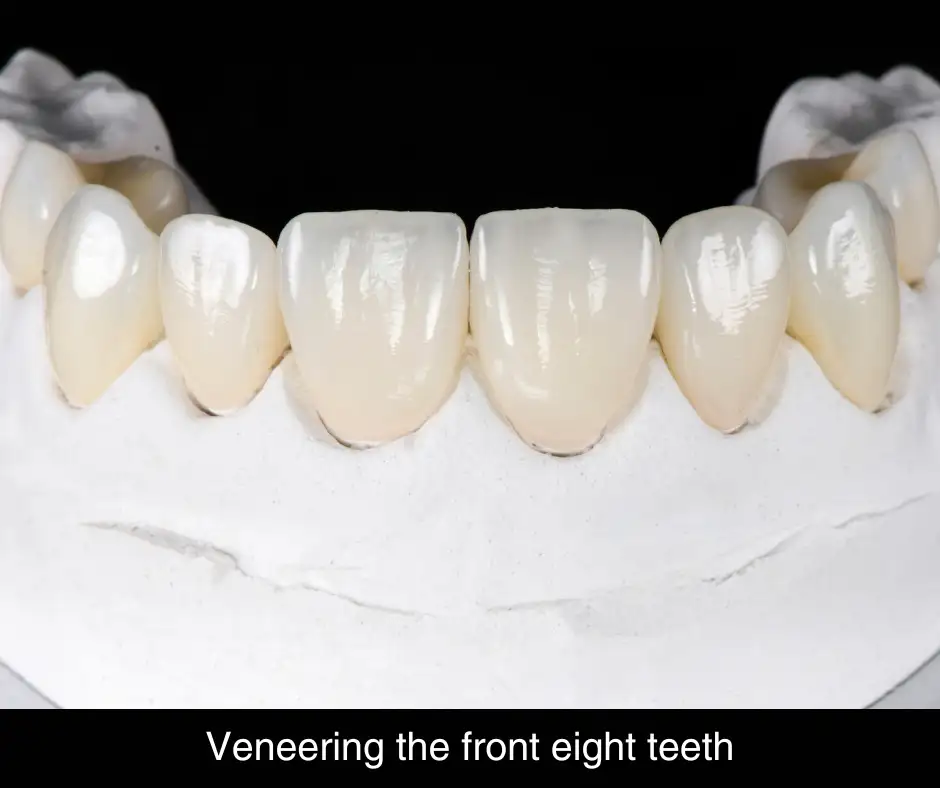 Dental implant with crown