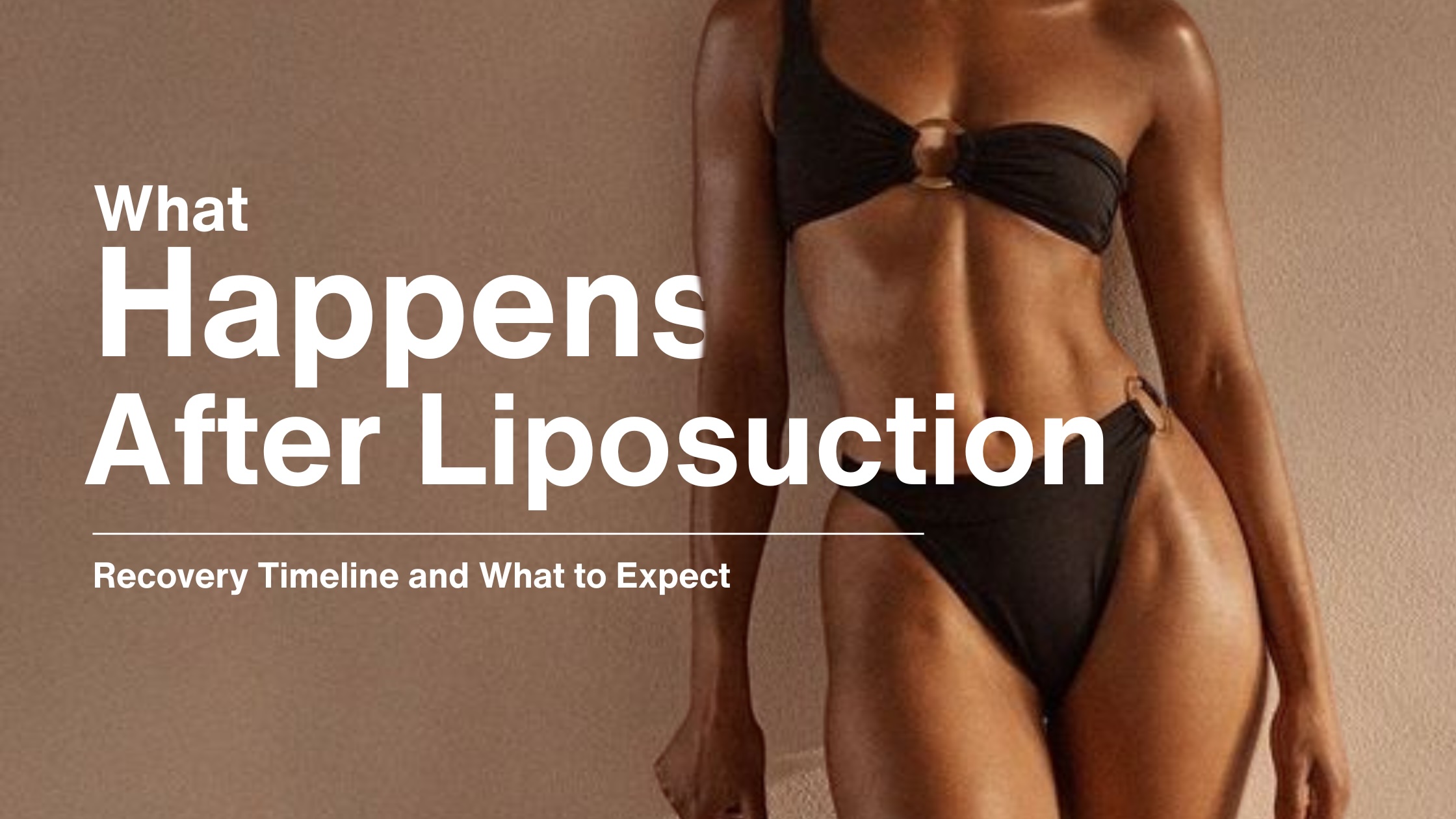 Post-liposuction patient wearing a compression garment during recovery in Thailand.