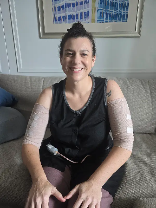 Racheal smiling while recovering at her hotel suite in Bangkok, wearing compression wraps on both arms after her brachioplasty.