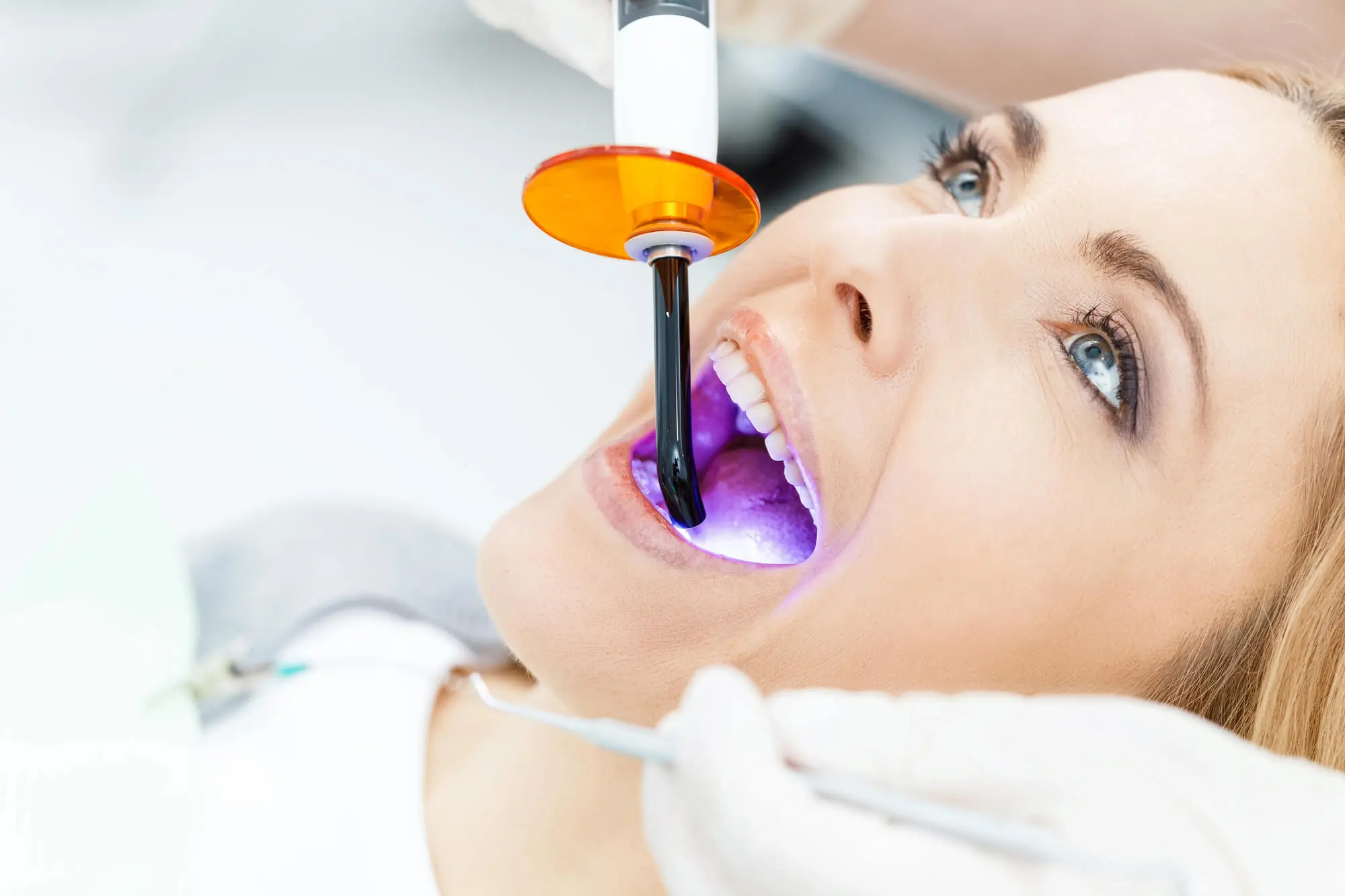 Safe Teeth Whitening in South Florida