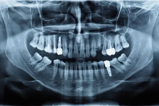 Naruto cosplay porno video