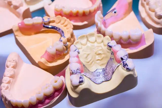 Teilprothese: Arten, Kosten, Halt & moderne Alternativen mit Implantaten im Überblick