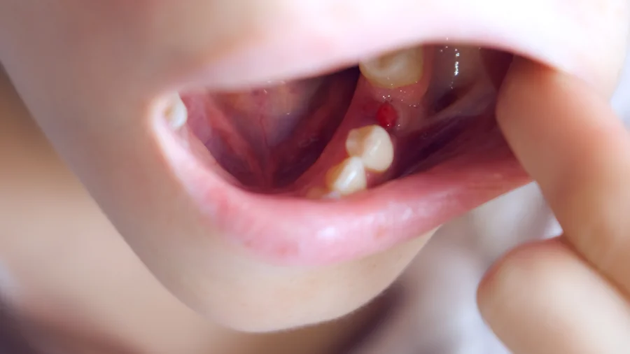 Wundheilung beschleunigen