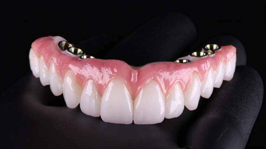 Zahnersatz Möglichkeiten