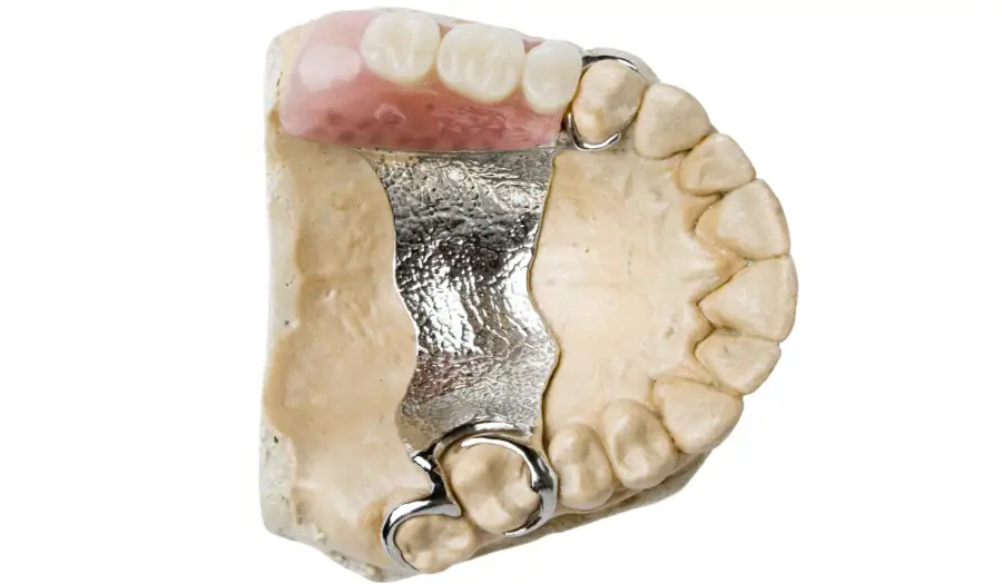 Klammerprothese Kosten