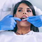 invisalign maryland