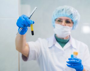 microneedling with PRP Maryland
